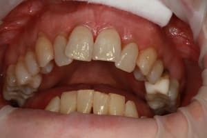 Img 8761 jh3p9q - Eugenol