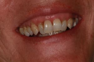 Img 8764 mn0nvy - Eugenol