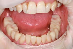 Img 8765 wslpyl - Eugenol