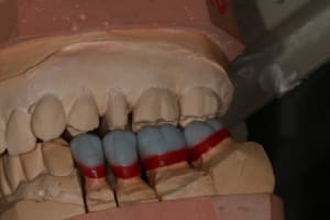 Img 8775 zyzyqo - Eugenol