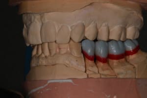 Img 8784 tnwjxy - Eugenol