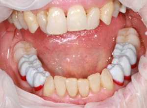 Img 8793 usbaie - Eugenol