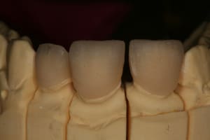 Img 8917 daqy0m - Eugenol