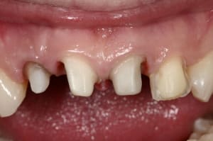 Img 9008 vwvsuc - Eugenol