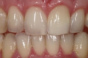 Img 9131 xknfaq - Eugenol