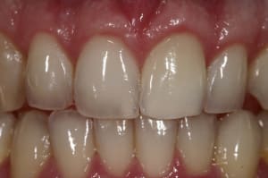 Img 9132 emw9hu - Eugenol
