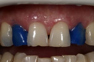 Img 9410 htxpis - Eugenol