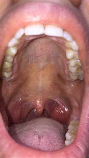 Img 9653 kwiudg - Eugenol