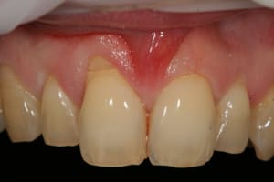 Img 9685 pvamp0 - Eugenol