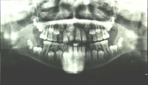 Img 9804 hm3kut - Eugenol