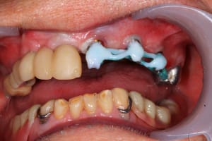 Img 9860 2 vpmfp7 - Eugenol