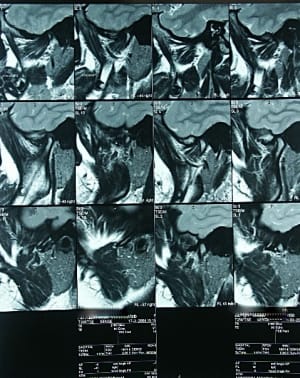 Irmatm tb9z6p - Eugenol
