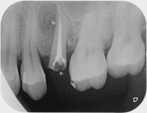 Image002 gpjjmu - Eugenol