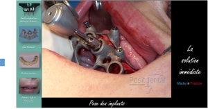 Image16 jawwbk - Eugenol