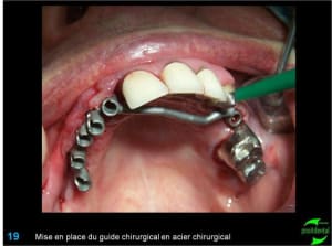 Image19 ixdo8k - Eugenol