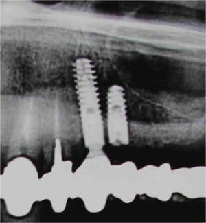 Image1 fhugwl - Eugenol