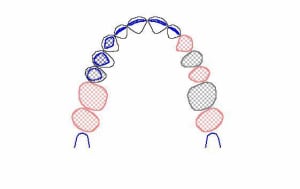 Image31 dtstfs - Eugenol