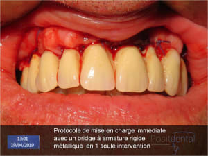 Image34 khmi0e - Eugenol