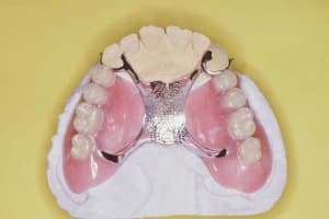 Image3 bbrxqe - Eugenol