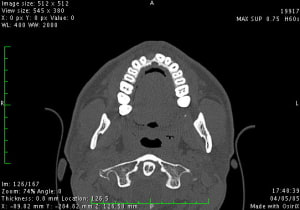 Image4 vfgrxh - Eugenol
