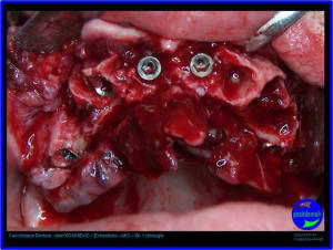 Image6 ymphpa - Eugenol