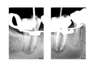 Image6 ytgwbx - Eugenol