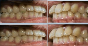 Image8 teent9 - Eugenol