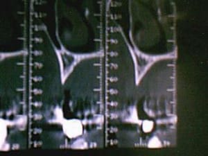 Image 002 brrbyi - Eugenol