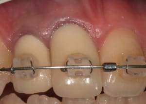 Image 6 jhhxmw - Eugenol