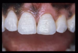 Image centr 11 roinuw - Eugenol