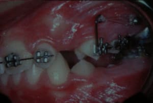 Img 1982 jukiut - Eugenol