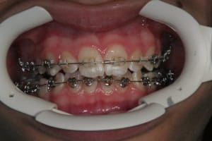 Img 3370 w6sdd5 - Eugenol