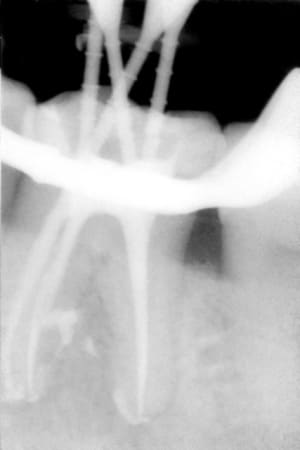 Jm endo wy7cpd - Eugenol