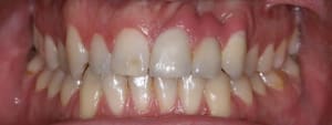 J 30 fliahj - Eugenol