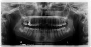 L1 nqke5f - Eugenol