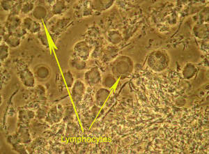 Lympho ofq9ra - Eugenol