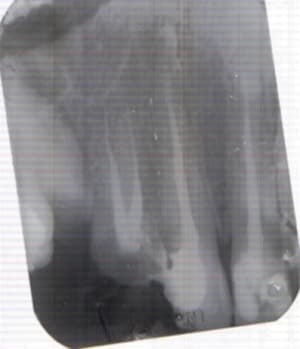 Lastscan petite dernière gebyht - Eugenol
