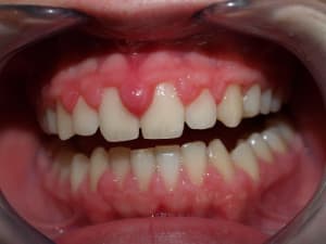 M1115782 xuhy97 - Eugenol
