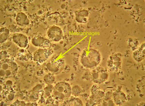 Macrophages whxg0y - Eugenol