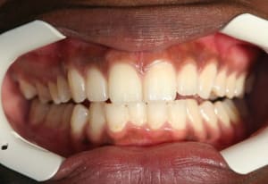 Motif de consultation 4308 xgfgkk - Eugenol