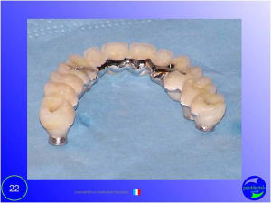 Mise en chage imm diate 022 ulx33j - Eugenol