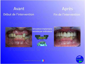 Mise en chage imm diate 025 wjjoj3 - Eugenol