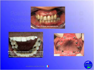 Mise en chage imm diate 050 pajn0d - Eugenol