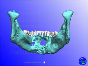 Mise en chage imm diate 063 z6nevf - Eugenol