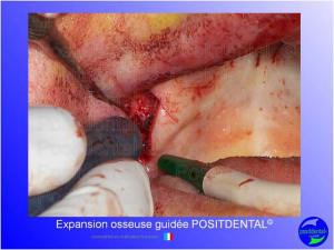 Mise en chage imm diate 134 m9mmo7 - Eugenol