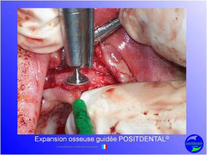 Mise en chage imm diate 146 kylao0 - Eugenol