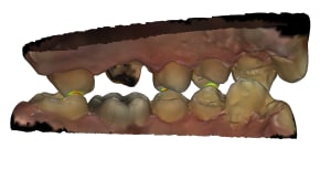 Occlusion 2 id62 gy1a9o - Eugenol
