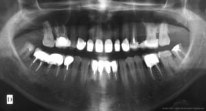 Occlusodontologie 06 duh5ww - Eugenol