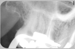 Oups v1kjn8 - Eugenol