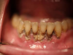 P1010581 muu3sl - Eugenol